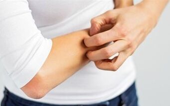 Η κνησμό μπορεί να αναφέρεται ως το πρώτο σημάδι της νόσου