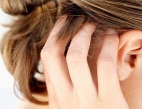 Σημάδια και συμπτώματα ψωρίασης στο τριχωτό της κεφαλής